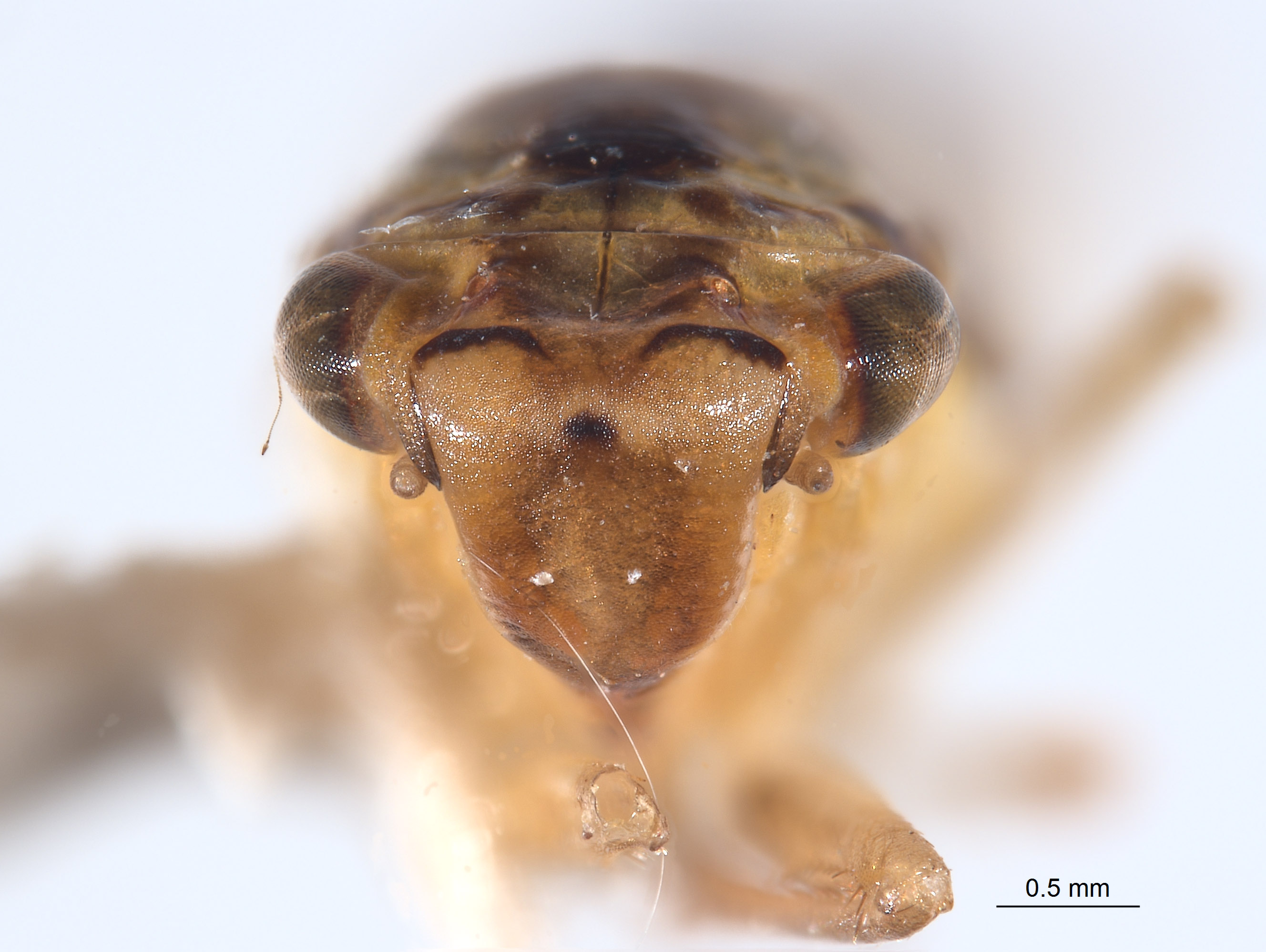 Anatkina galgala image